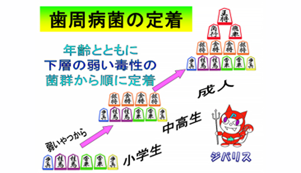 「歯周病菌の定着」年齢とともに下層の弱い毒性の菌軍から順に定着