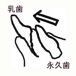 エスカレーター式交換